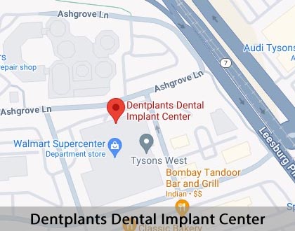 Map image for The Difference Between Dental Implants and Mini Dental Implants in Tysons, VA