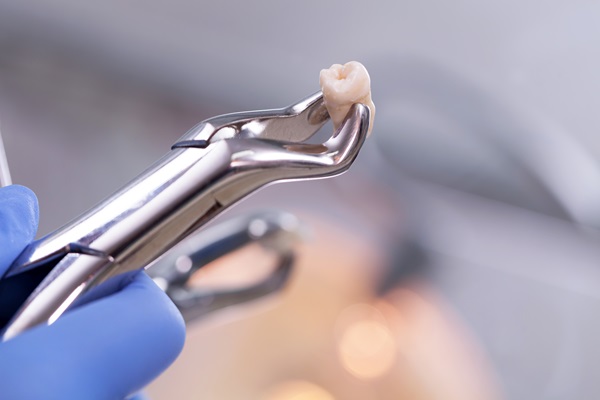 Tooth Extraction For Wisdom Teeth